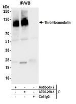 Thrombomodulin Antibody in Immunoprecipitation (IP)