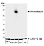 Thrombomodulin Antibody in Western Blot (WB)