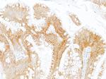 LOX-1 Antibody in Immunohistochemistry (Paraffin) (IHC (P))