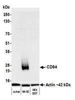 CD94 Antibody in Western Blot (WB)