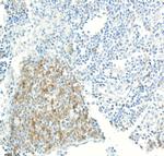 CD70 Antibody in Immunohistochemistry (Paraffin) (IHC (P))