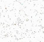 INSM1 Antibody in Immunocytochemistry (ICC/IF)