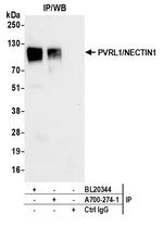 PVRL1/NECTIN1 Antibody in Immunoprecipitation (IP)