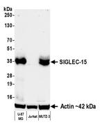 SIGLEC-15 Antibody in Western Blot (WB)