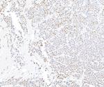 ARID1A/BAF250 Antibody in Immunohistochemistry (Paraffin) (IHC (P))