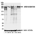 ARID1A/BAF250 Antibody in Western Blot (WB)