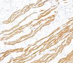 Troponin I Antibody in Immunohistochemistry (Paraffin) (IHC (P))