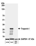 Troponin I Antibody in Western Blot (WB)