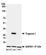 Troponin I Antibody in Western Blot (WB)