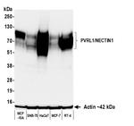 PVRL1/NECTIN1 Antibody in Western Blot (WB)