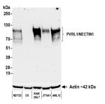 PVRL1/NECTIN1 Antibody in Western Blot (WB)