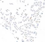 DPP4/CD26 Antibody in Immunocytochemistry (ICC/IF)