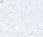 NKG2A Antibody in Immunohistochemistry (Paraffin) (IHC (P))