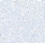 NKG2A Antibody in Immunohistochemistry (Paraffin) (IHC (P))