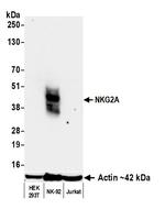 NKG2A Antibody in Western Blot (WB)