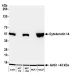 Cytokeratin 14 Antibody in Western Blot (WB)