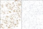 E-Selectin/CD62E Antibody in Immunocytochemistry (ICC/IF)