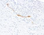 E-Selectin/CD62E Antibody in Immunohistochemistry (Paraffin) (IHC (P))