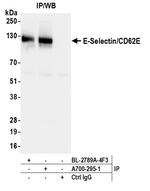 E-Selectin/CD62E Antibody in Immunoprecipitation (IP)