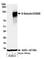 E-Selectin/CD62E Antibody in Western Blot (WB)