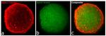 Rat IgG (H+L) Highly Cross-Adsorbed Secondary Antibody in Immunocytochemistry (ICC/IF)