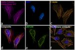 Rat IgG (H+L) Highly Cross-Adsorbed Secondary Antibody in Immunocytochemistry (ICC/IF)