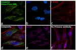 Chicken IgY (H+L) Highly Cross Adsorbed Secondary Antibody in Immunocytochemistry (ICC/IF)