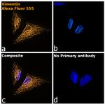 Chicken IgY (H+L) Highly Cross Adsorbed Secondary Antibody in Immunocytochemistry (ICC/IF)