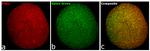 Chicken IgY (H+L) Highly Cross Adsorbed Secondary Antibody in Immunocytochemistry (ICC/IF)