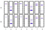 Daratumumab Antibody in Immunoelectrophoresis (IE)