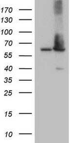 AAAS Antibody in Western Blot (WB)