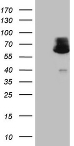 AAAS Antibody in Western Blot (WB)