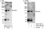 AAK1 Antibody in Western Blot (WB)
