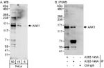 AAK1 Antibody in Western Blot (WB)