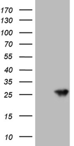 AANAT Antibody in Western Blot (WB)