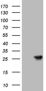 AANAT Antibody in Western Blot (WB)