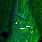 Adenosine A2A Receptor Antibody in Immunohistochemistry (Paraffin) (IHC (P))