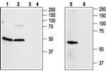Adenosine A2A Receptor Antibody in Western Blot (WB)