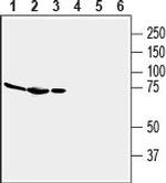 Adenosine A2A Receptor (extracellular) Antibody in Western Blot (WB)