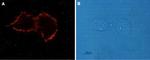 Angiotensin II Receptor Type-1 (extracellular) Antibody in Immunocytochemistry (ICC/IF)