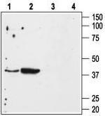 Angiotensin II Receptor Type-1 (extracellular) Antibody in Western Blot (WB)