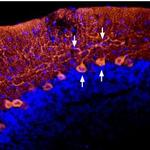 Angiotensin II Receptor Type-1 (extracellular) Antibody in Immunohistochemistry (Frozen) (IHC (F))