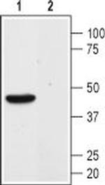Angiotensin-(1-7) Mas Receptor Antibody in Western Blot (WB)