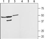 Angiotensin-(1-7) Mas Receptor Antibody in Western Blot (WB)