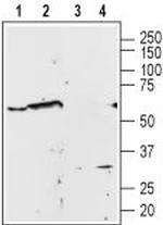 alpha 1A-Adrenergic Receptor (extracellular) Antibody in Western Blot (WB)