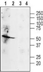 beta 2-Adrenergic Receptor (extracellular) Antibody in Western Blot (WB)