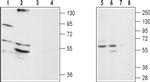 alpha 1D-Adrenergic Receptor (extracellular) Antibody in Western Blot (WB)