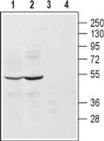 alpha 2A-Adrenergic Receptor (extracellular) Antibody in Western Blot (WB)