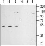 alpha 2C-Adrenergic Receptor (extracellular) Antibody in Western Blot (WB)