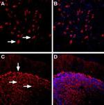 beta 1-Adrenergic Receptor (extracellular) Antibody in Immunohistochemistry (IHC)